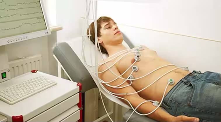 EKG